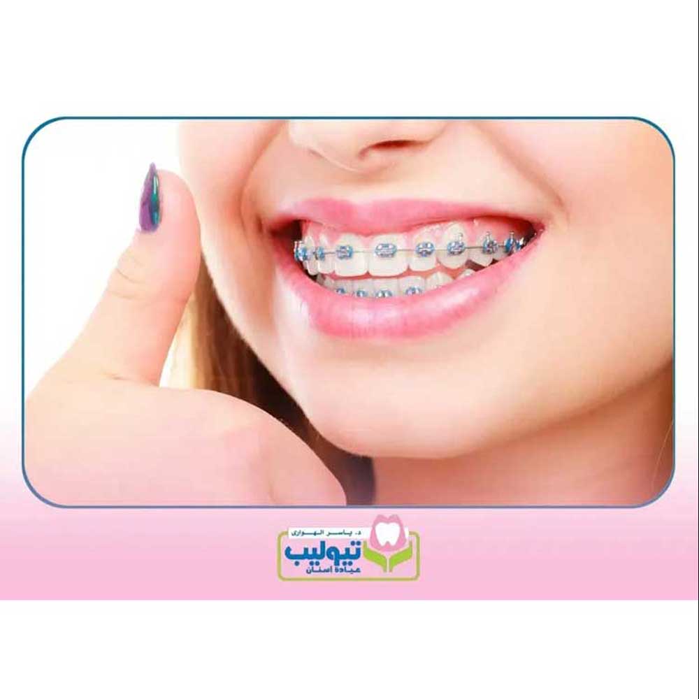 Orthodontics