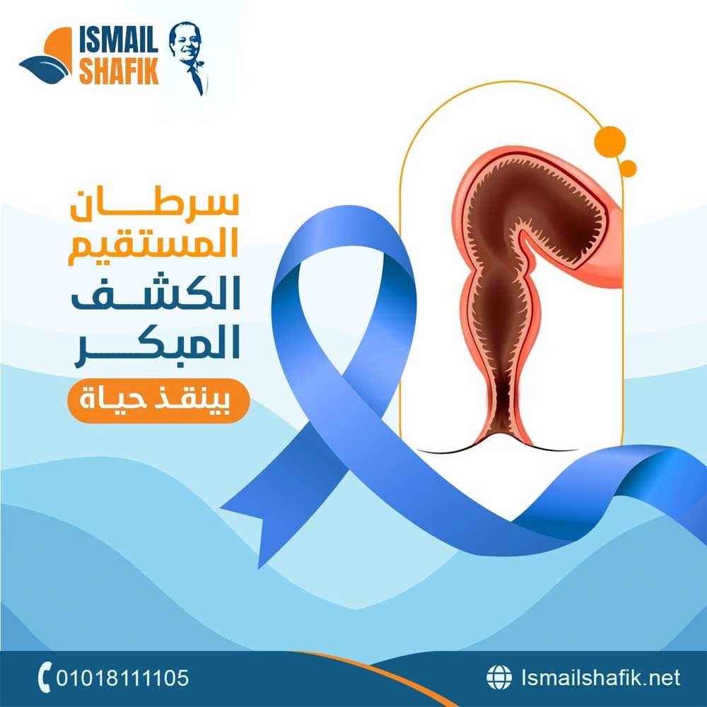 Treatment of Rectal Cancer