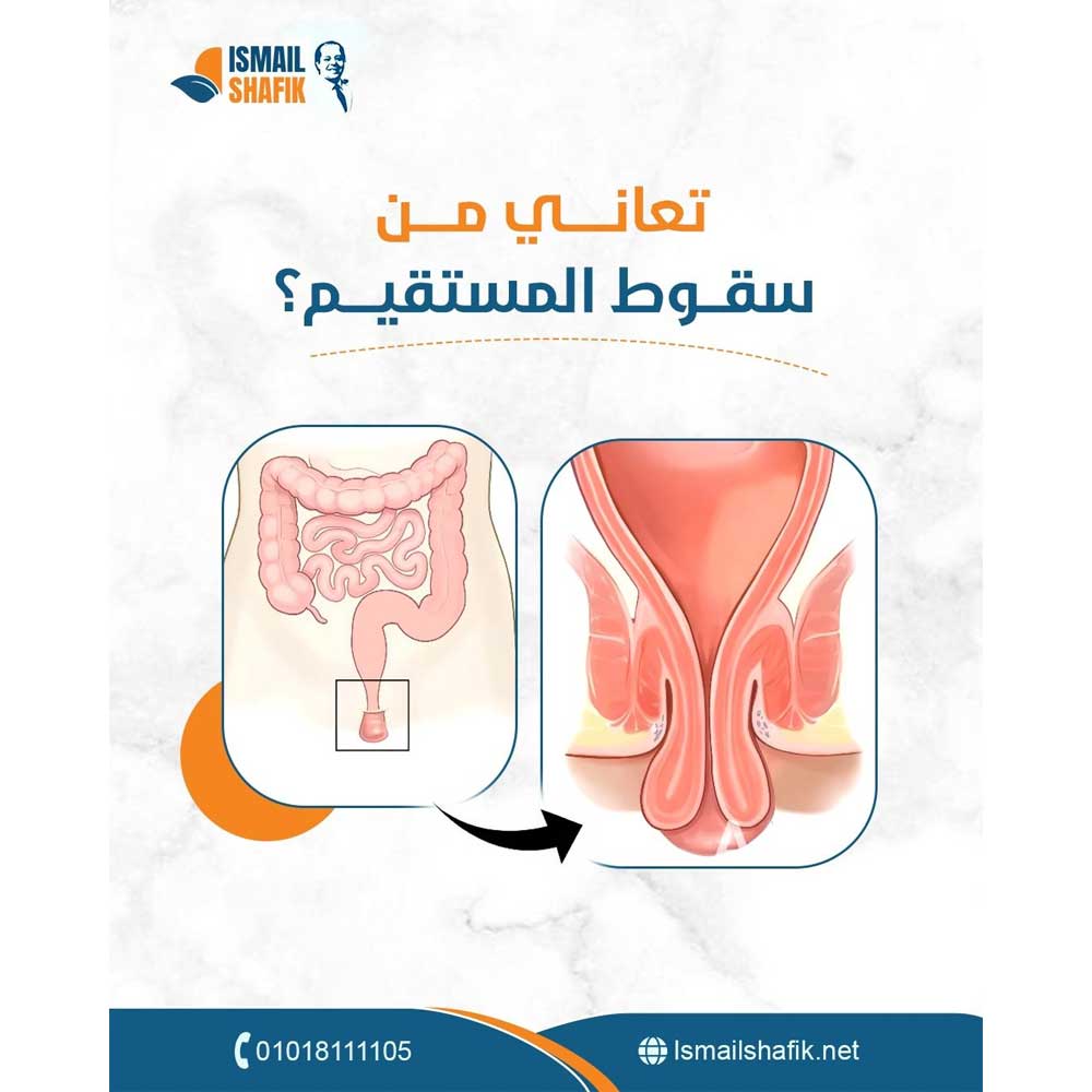 Treatment of Rectal Cancer
